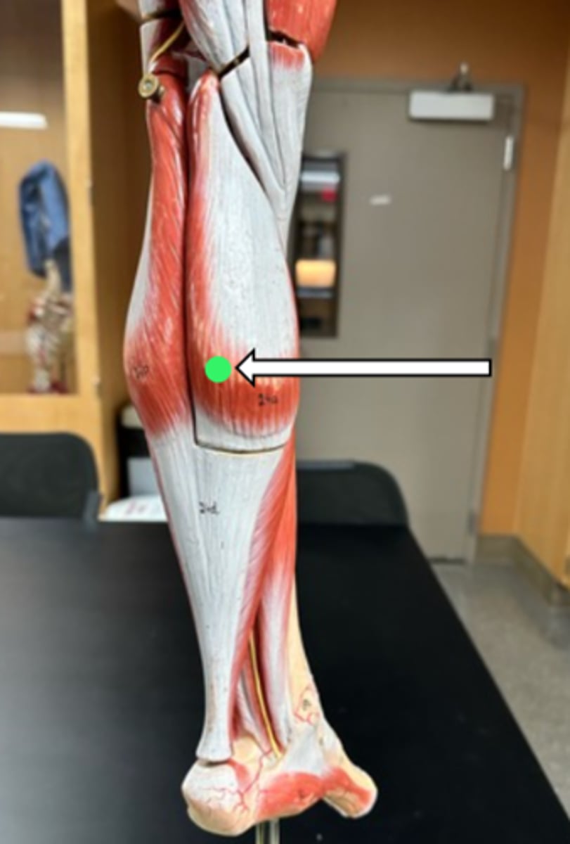 <p>gastrocnemius (function)</p>