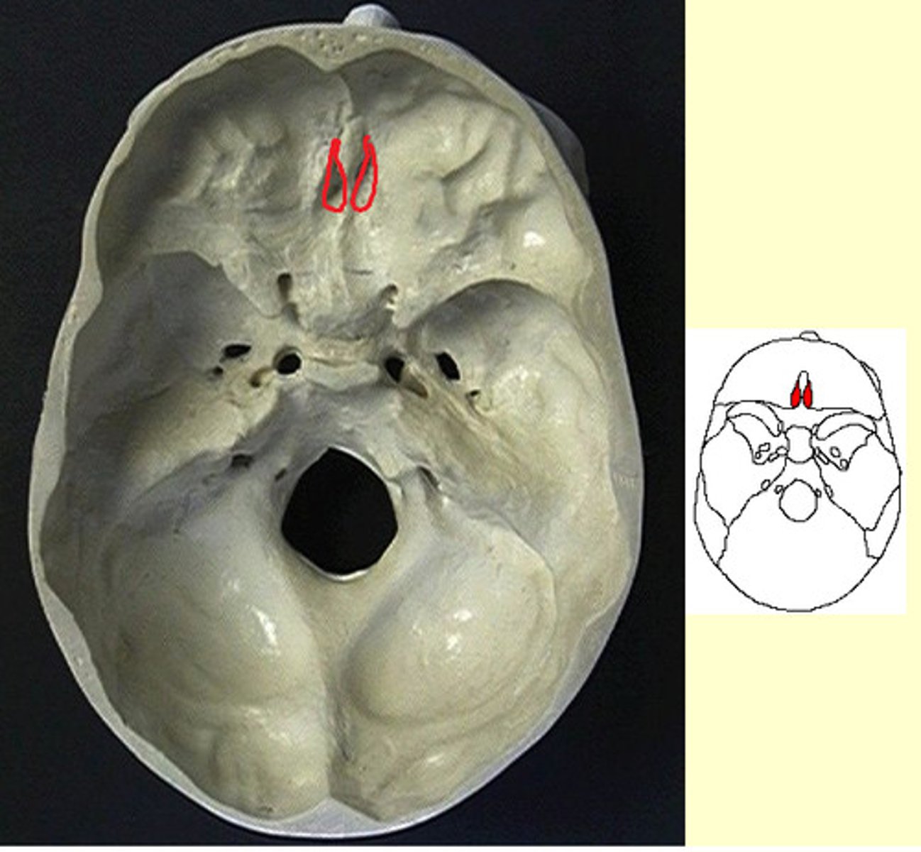 knowt flashcard image