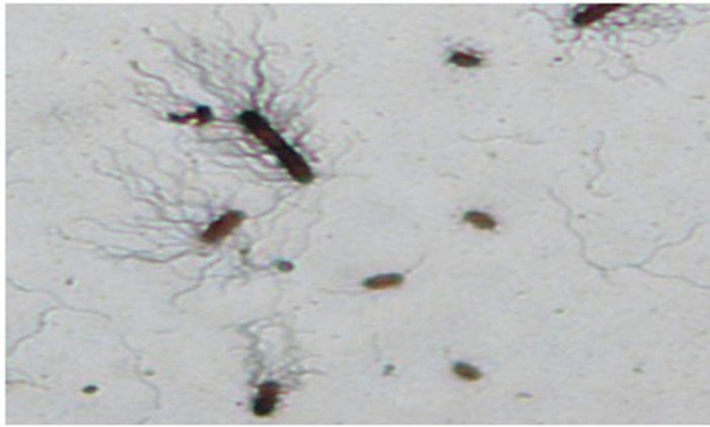 <p>What type of stain is this?</p>