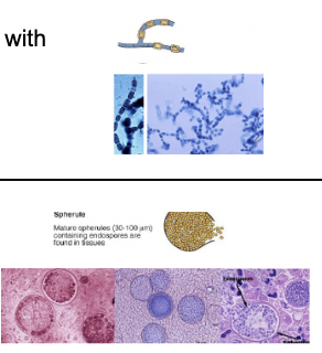 <p>Mould - septate hyphae which fragment into arthroconidia with arthrospores </p><p>Yeast - mature spherules are filled with endospores and are found in tissues </p>