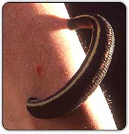<p><span>•Segmented worms</span></p><p><span>•Characteristics</span></p><p><span>•Vermiform</span></p><p><span>•Trochophore larval stage (shared with Molluscs)</span></p><p><span>•Segmented body (convergent with arthropods and vertebrates)</span></p><p><span>•Truly segmented body cavity</span></p><p><span>•Divided by septa</span></p><p><span>•Closed circulatory system (convergent with vertebrates and cephalopods)</span></p><p><span>•Cerebral ganglion &amp; ventral nerve cord</span></p><p><span>Classes:</span></p><p><span>Errant</span></p><p><span>Sedentaria</span></p>