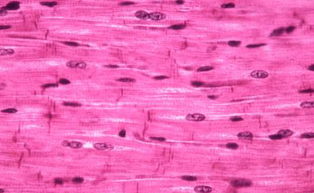 <p>Striated cells, one nucleus per cell, “branching”</p>