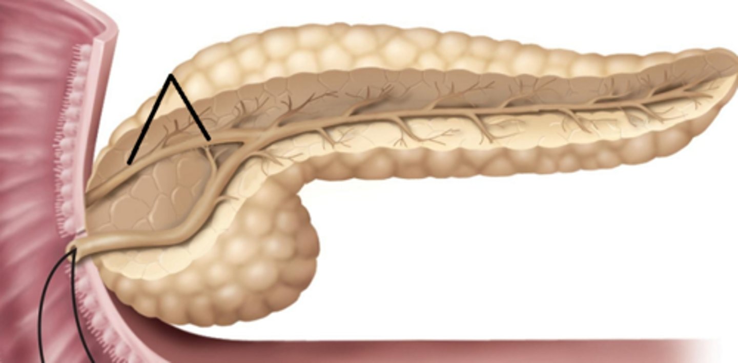 <p>What part of the pancreas is this?</p>
