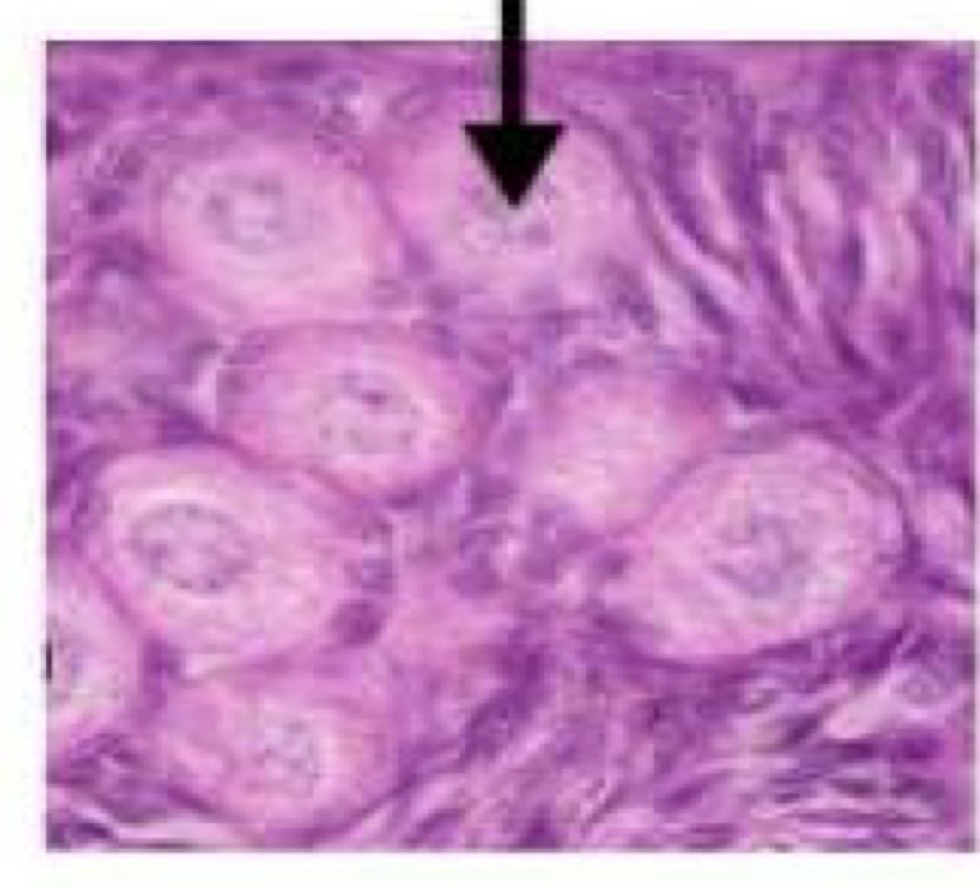 <p>Primordial follicles</p>