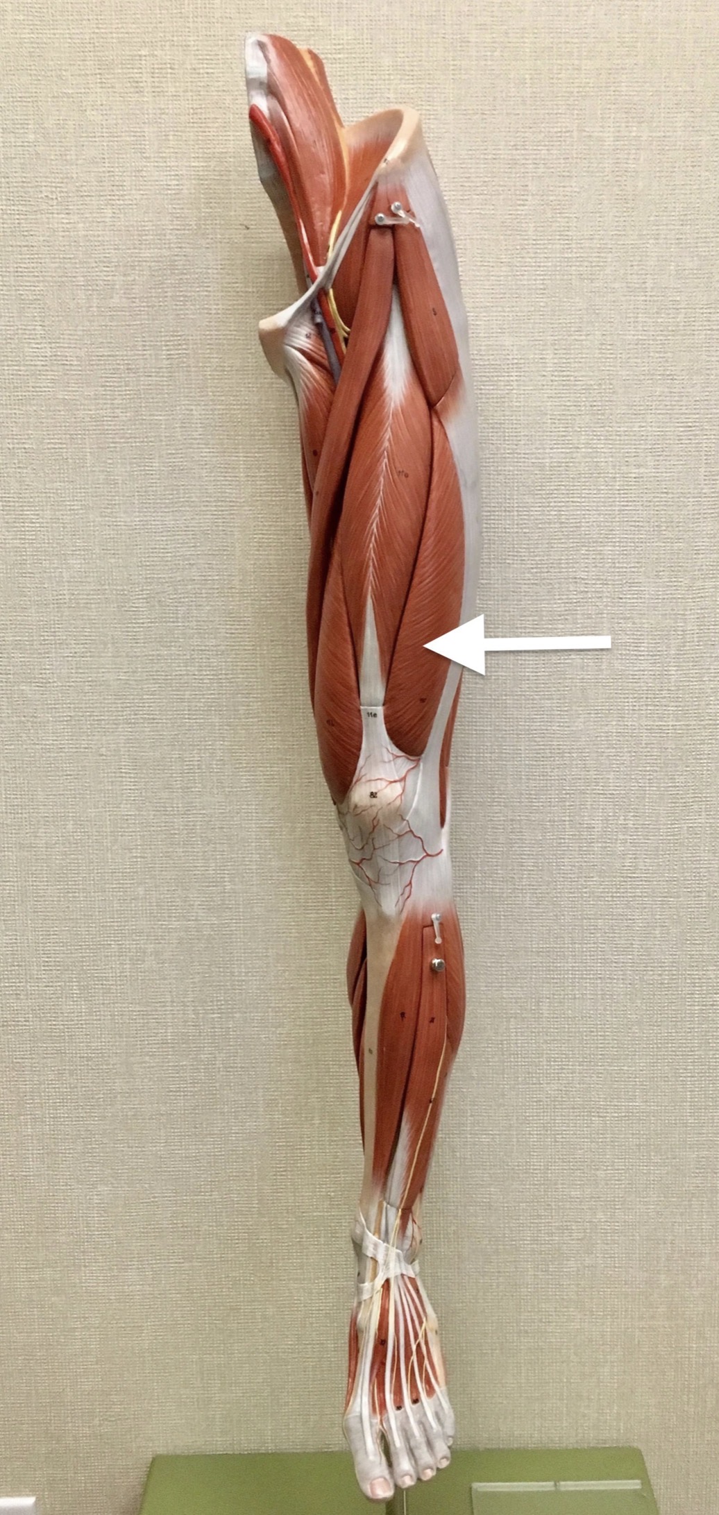 <p><span>Name the muscle labeled with the white arrow below:</span></p>
