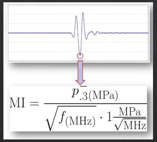 <p>the risk of mechanical bioeffects can be measured using the </p>