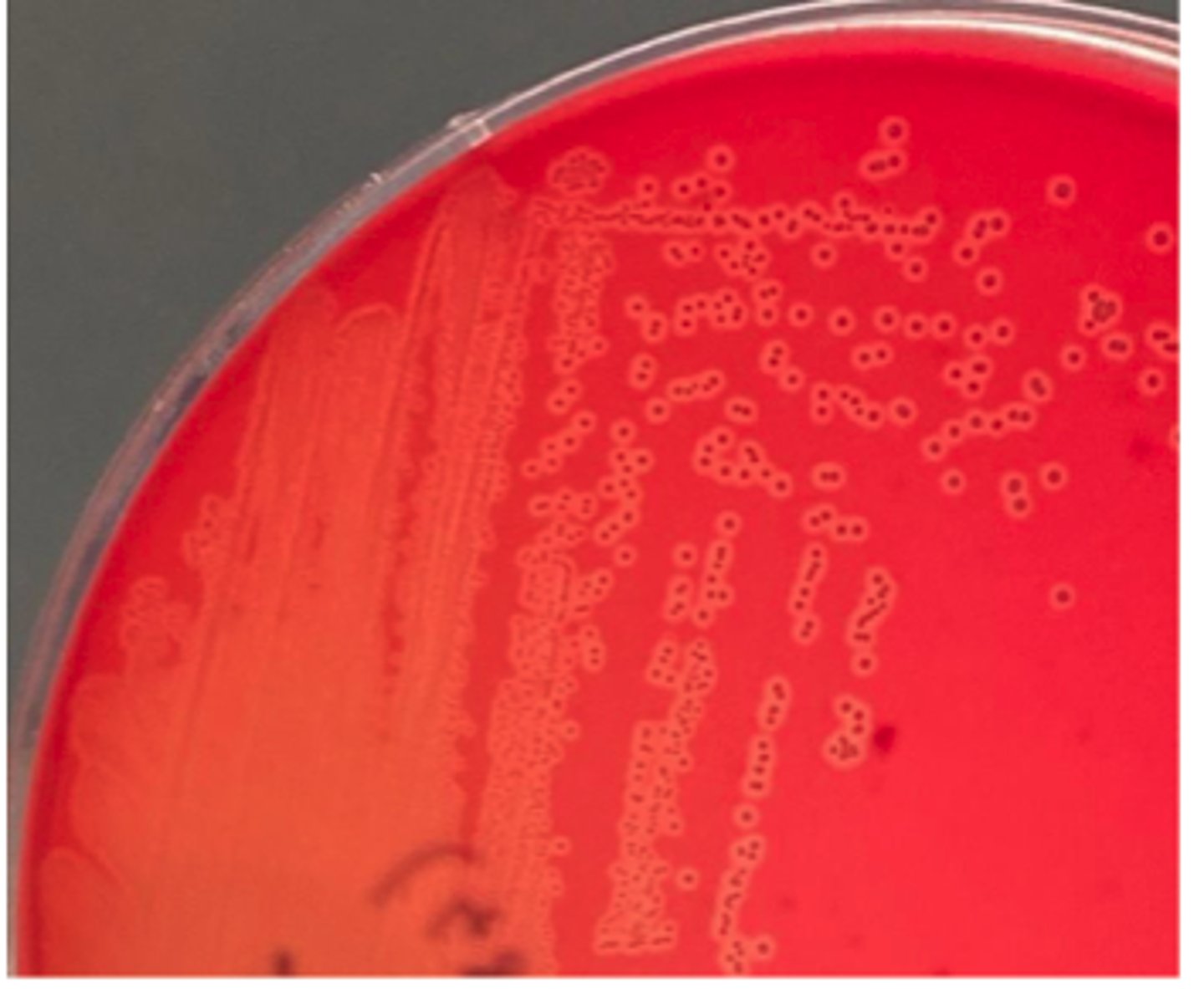 <p>A steer presented with a penetrating wound in the pectoral muscles. A swab of purulent material was collected during surgical management. 48 hr cultures on BA are provided. There was no growth on MacConkey agar. This pathogen is catalase-negative and</p><p>CAMP-positive (tests not shown).</p><p>Presumptive identification?</p>