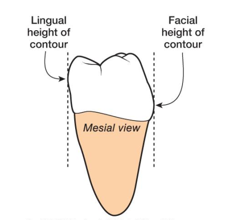 <ol><li><p>Your hand may block your vision of the lingual surface </p></li><li><p>Rounded posterior crowns make it difficult to place the working end on the root surface </p></li></ol><p>DO NOT tilt handle towards you, keep it upright </p><p></p>