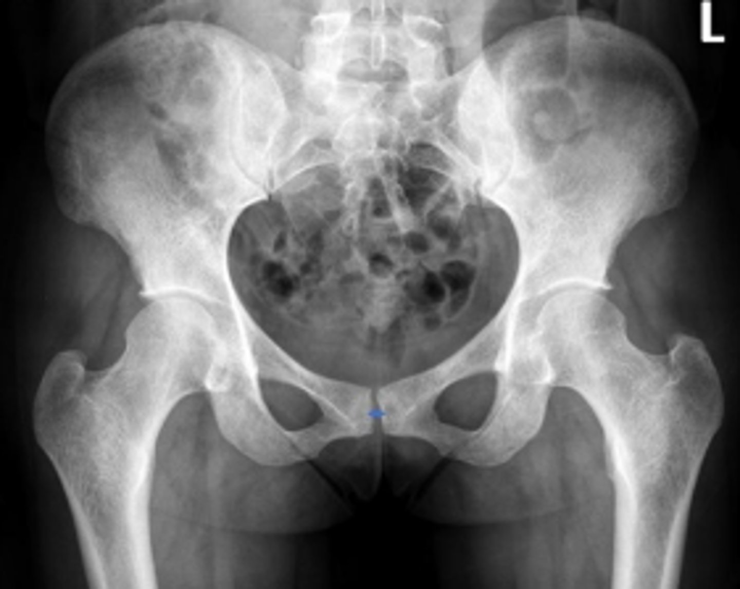 <p>Name the radiographic view</p>