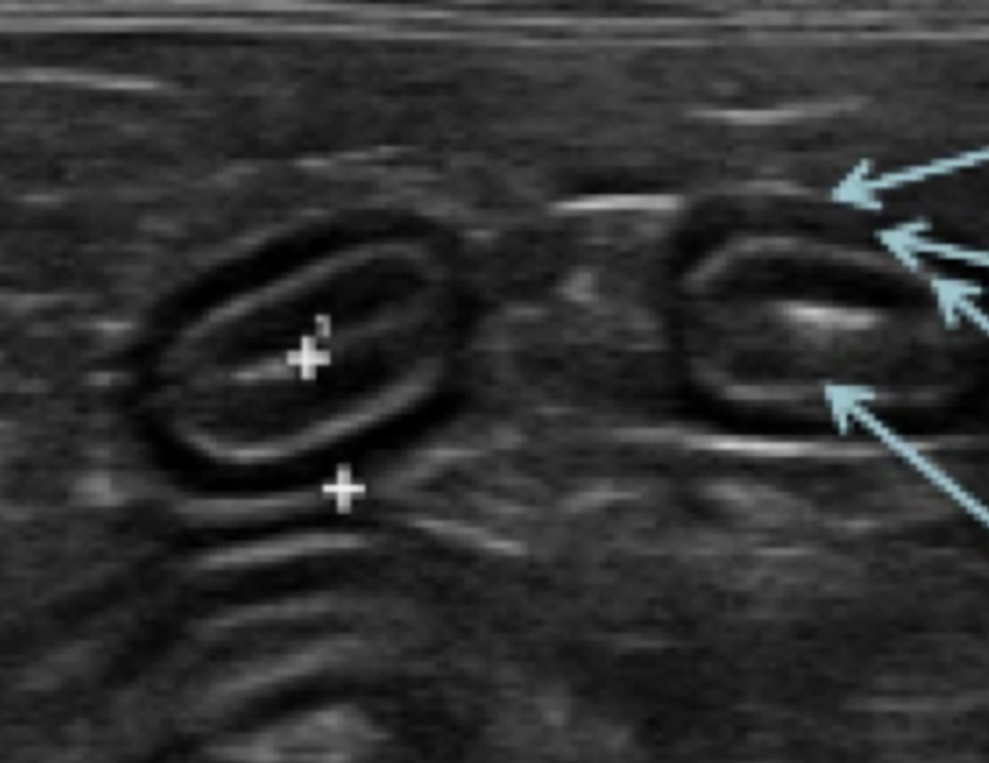 <p>¿qué parte del cuerpo?</p>