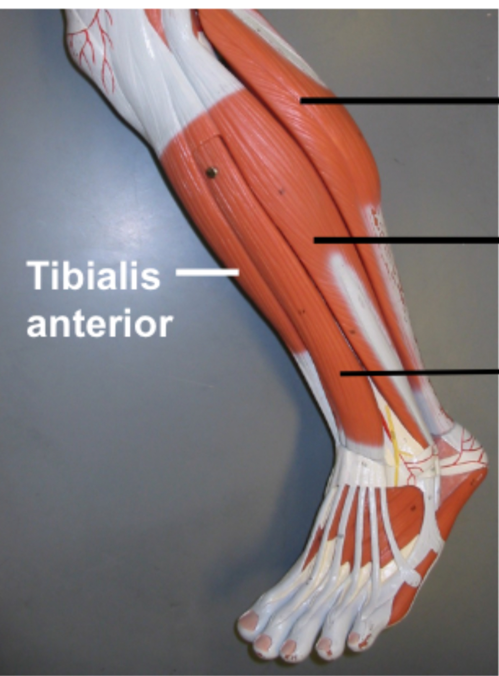 <p>action of peroneus longus</p>