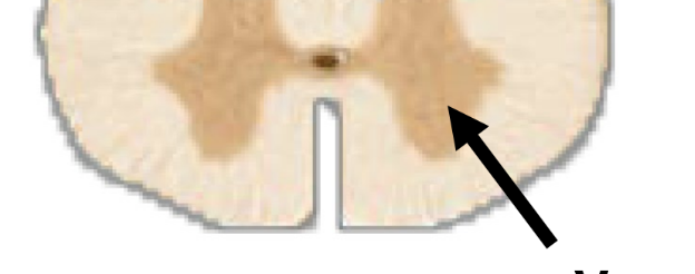 <p>cell bodies for motor neurons</p>