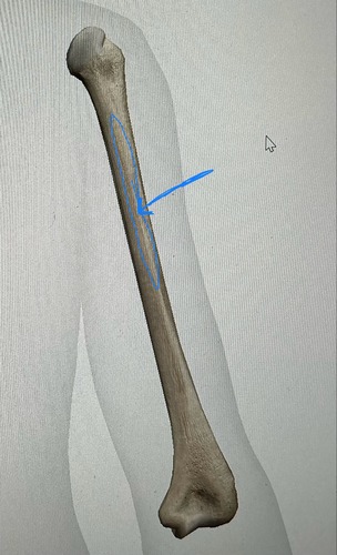 term image