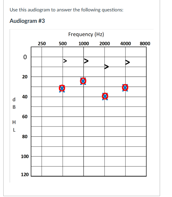 <p><strong>True or False: </strong><span>Bone conduction results in this test represent best bone conduction thresholds with the bone oscillator placed on the left.</span></p>