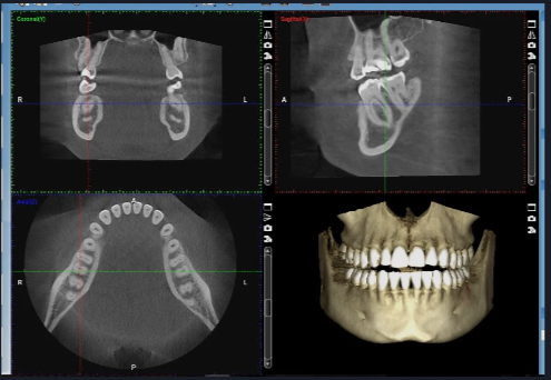 <p><span>Cone-Beam CT (CBCT)</span></p>