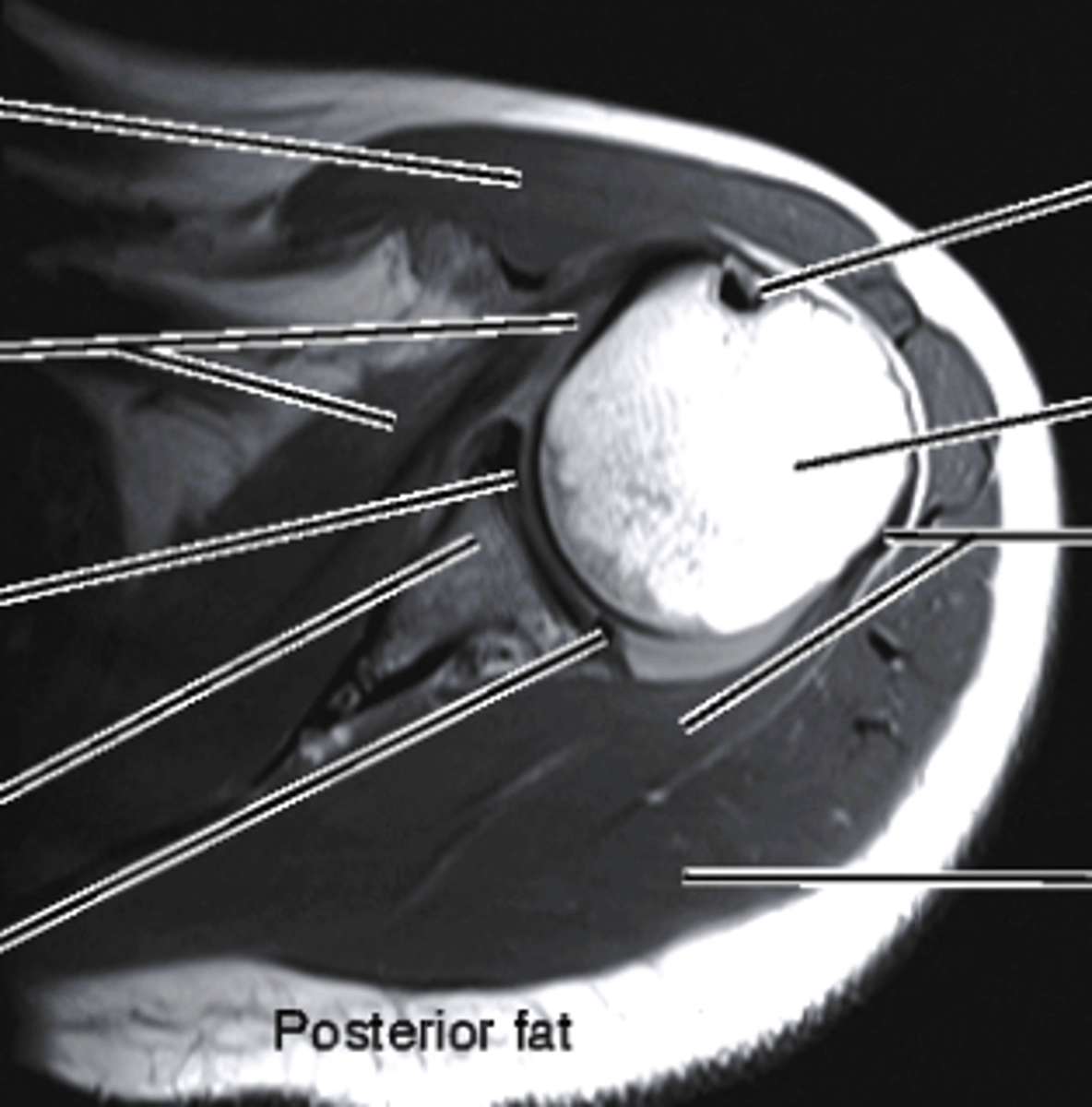 <p>what imaging type and view is this?</p>