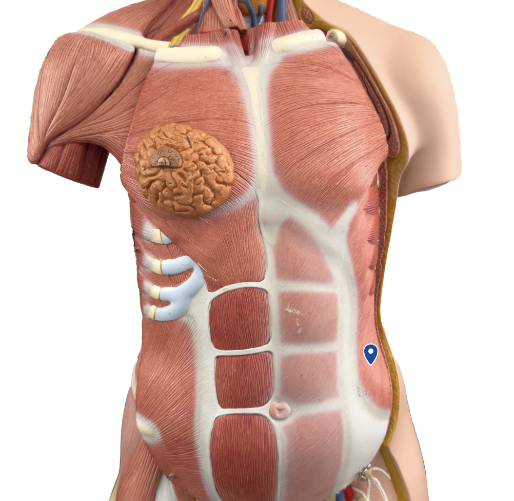 <p>What muscle is the arrow pointing to?</p>