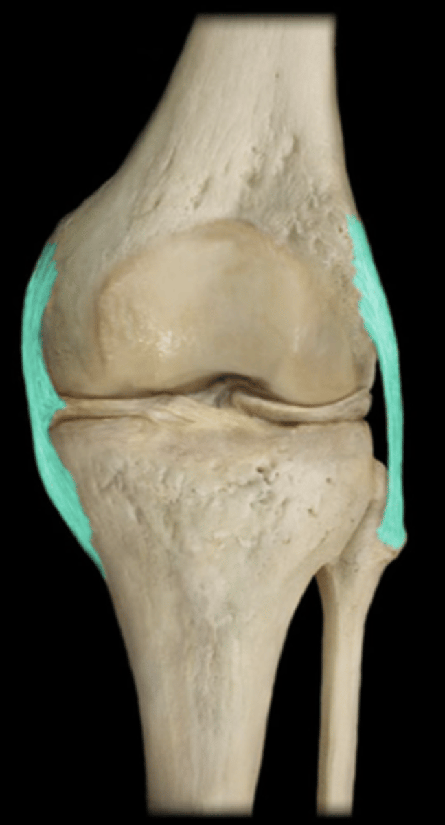 <p>right side of picture (lateral on patient)</p>