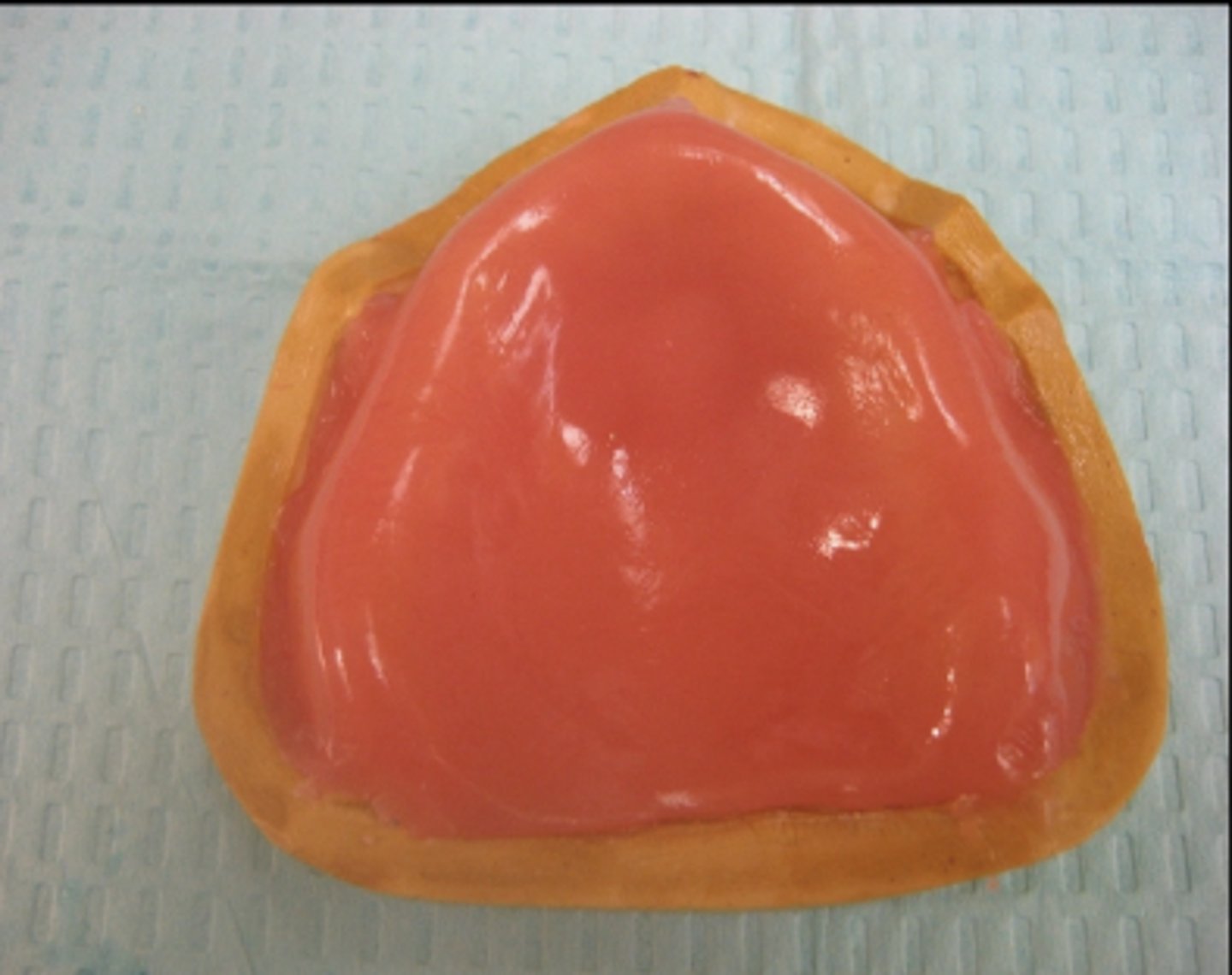 <p>When fabricating the maxillary record bases, be sure that the material completely fills the ___________ areas and is straight across the posterior aspect of the cast.</p>