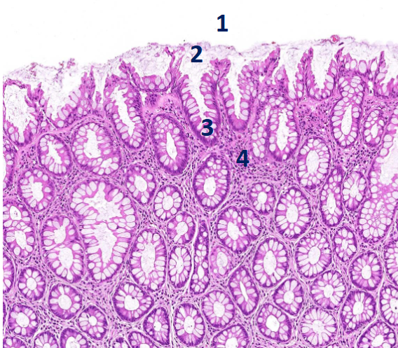 <p>what are the barriers against pathogen?</p>
