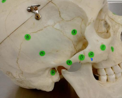 <p>#12 (lateral skull)</p>