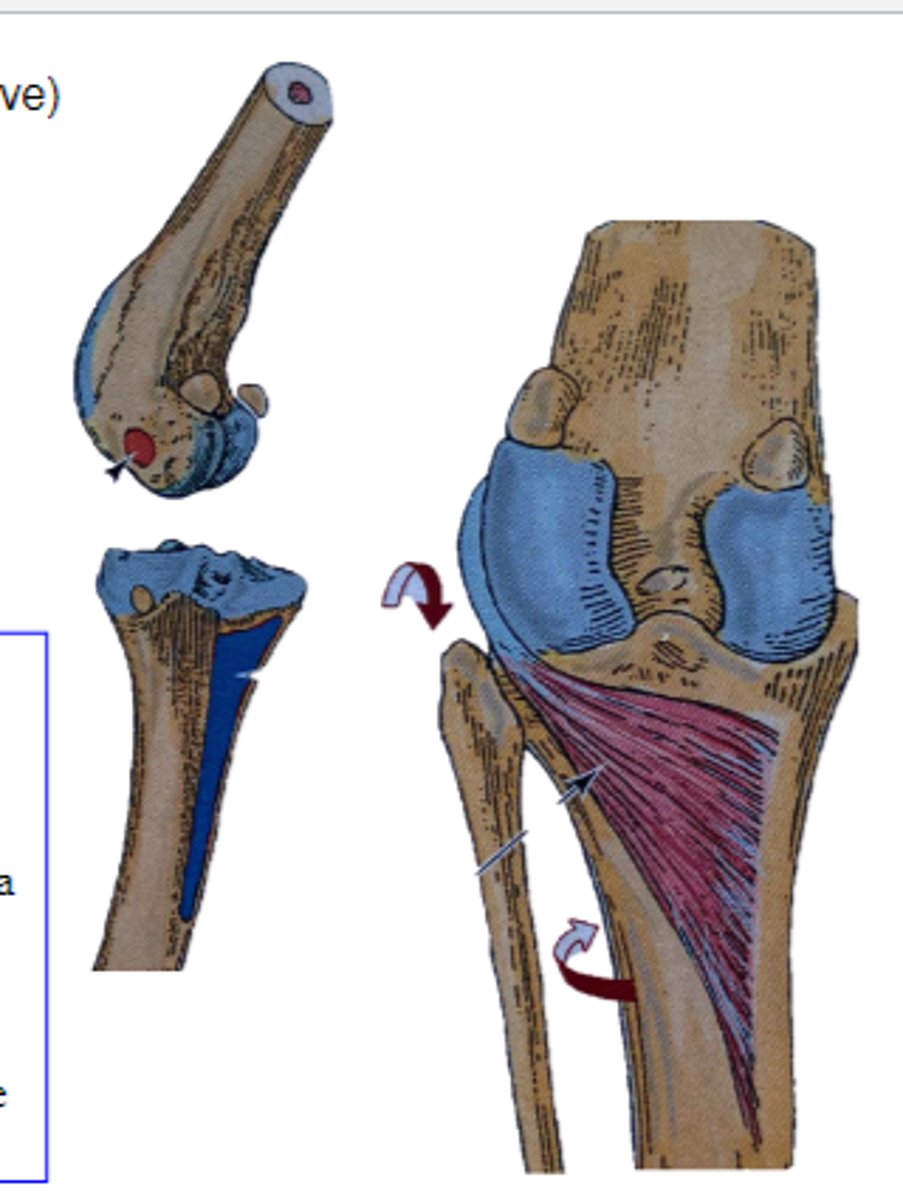 <p>What muscle is shown?</p>