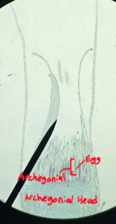 <p>Is the Archegonial Head part of the sporophyte or gametophyte generation?</p>