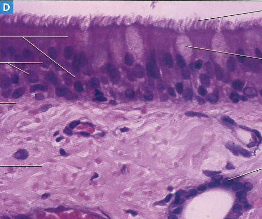 <p>What type of tissue is present in this image?</p>