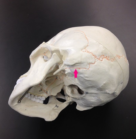 <p>Identify the suture.</p>