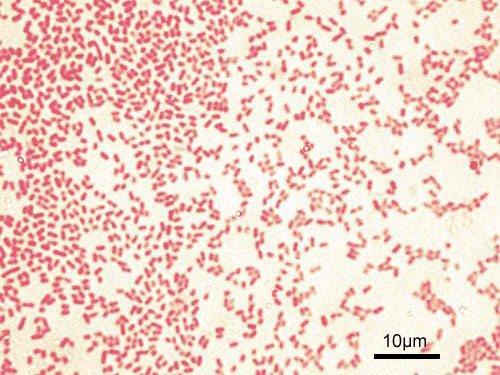 <p>Gram positive or gram negative bacteria?</p>
