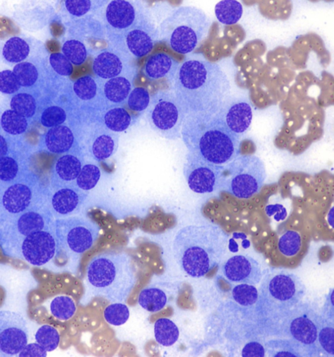<p>You are examining a cytology slide taken from a mass affixed to the anal sacs and note these clusters of moderately sized cells, round nuclei with stippled chromatin, moderate pale cytoplasm, and indistinct borders. </p><p>What is your top differential? </p>