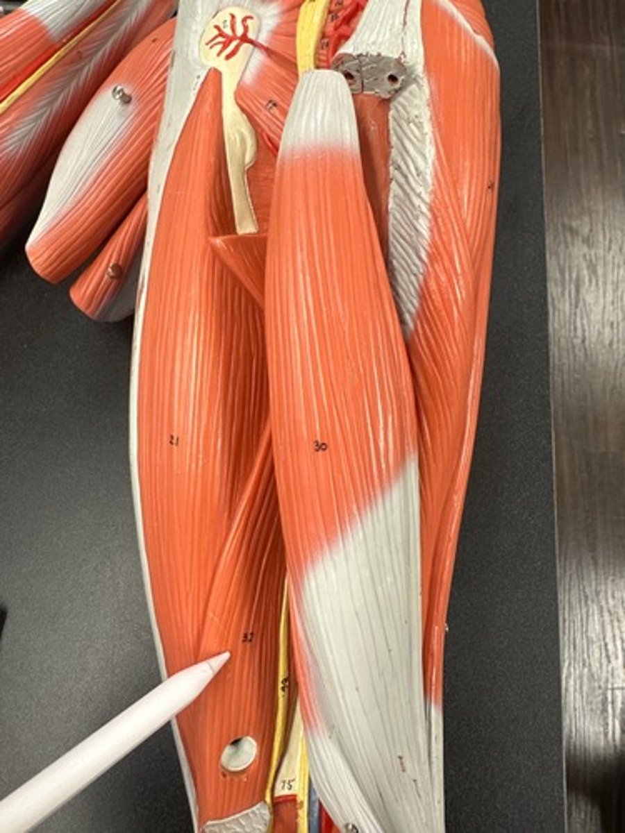 <p>What are the (3) attachments of the Biceps Femoris (Short Head)?</p>