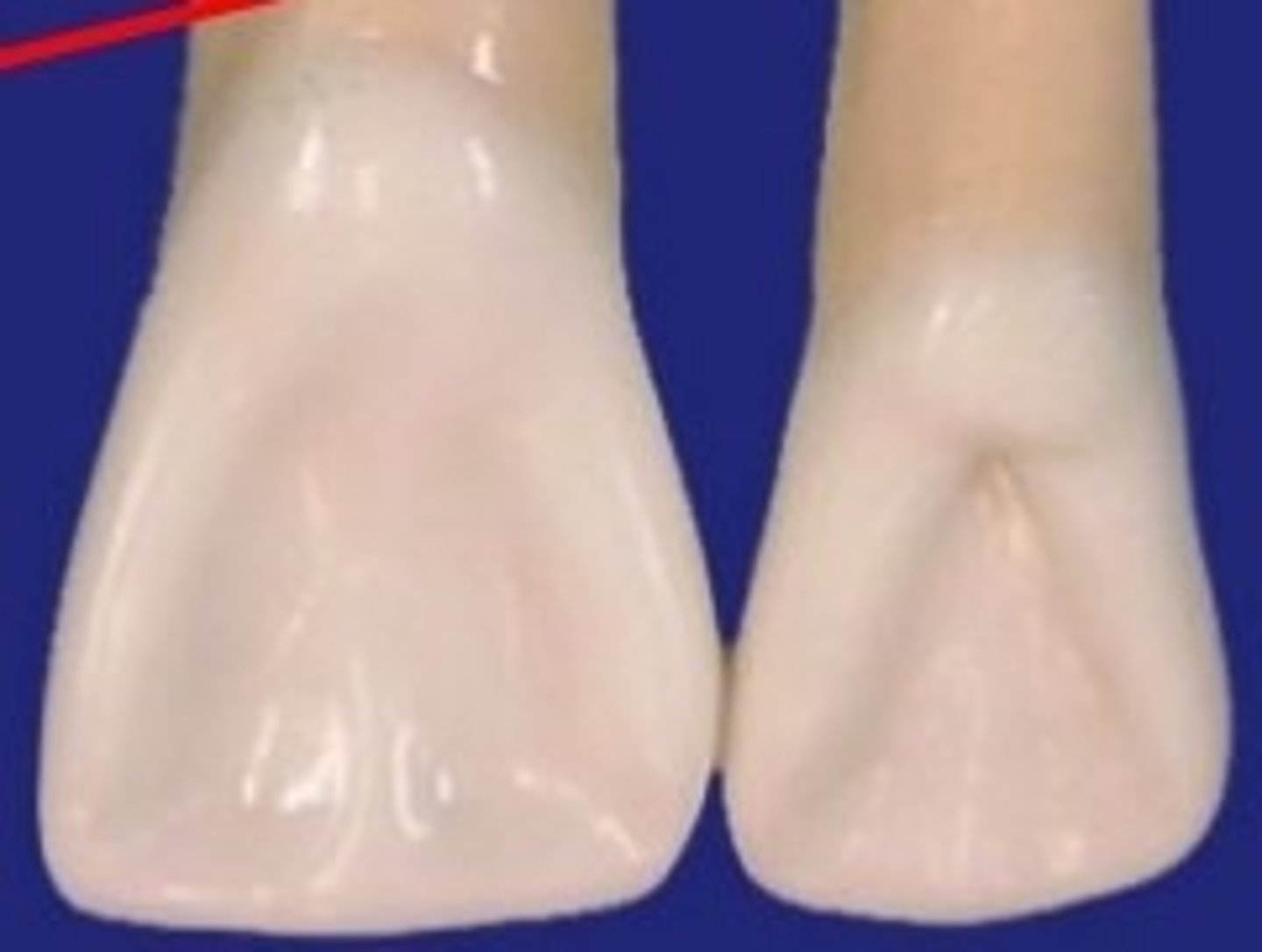 <p>Less prominent</p>