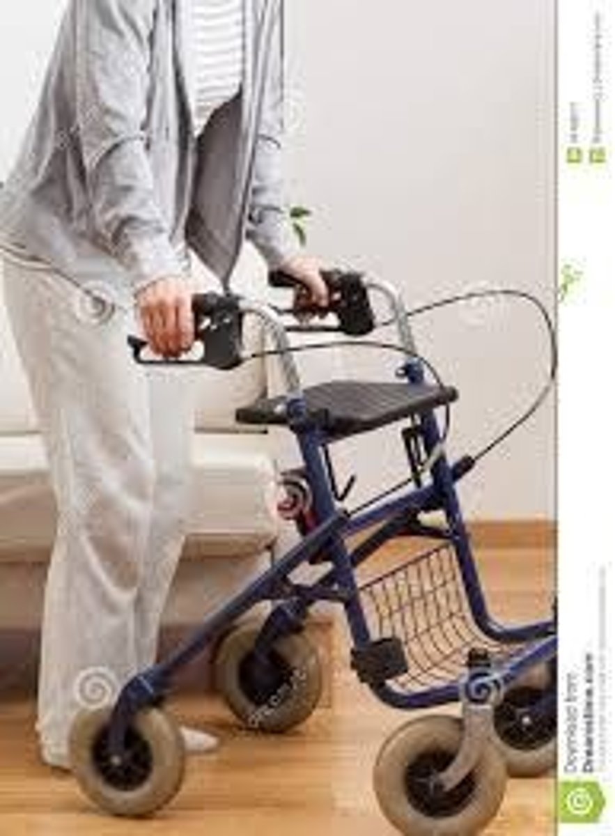 <p>Sizing the walker while the patient is standing erect, with elbows flexed 15-30 degrees.</p>