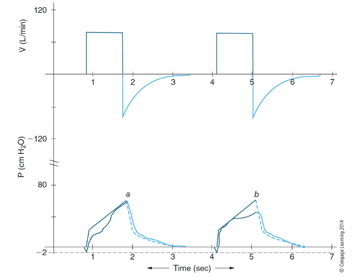 <p>What does the waveform look like if you have inadequate flow and or volume? </p>