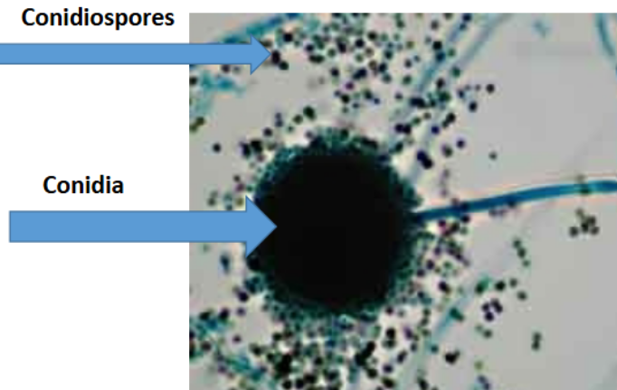 <ol><li><p>Conidiospores</p></li><li><p>Conidia</p></li></ol><p></p>
