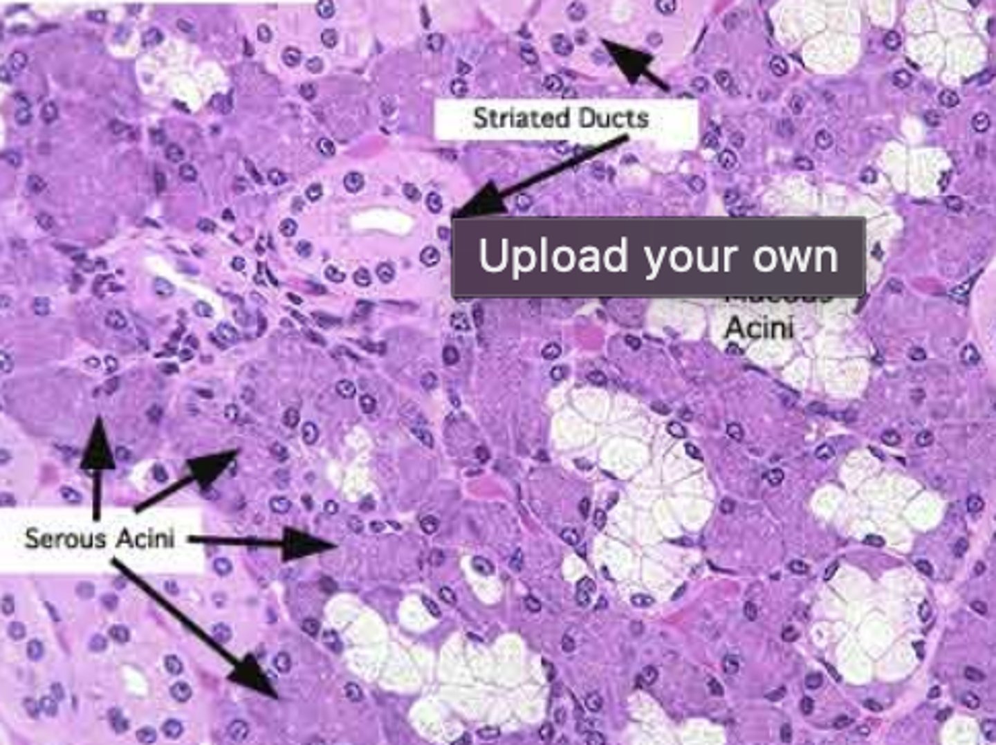 <p>mix of serous and mucous</p>