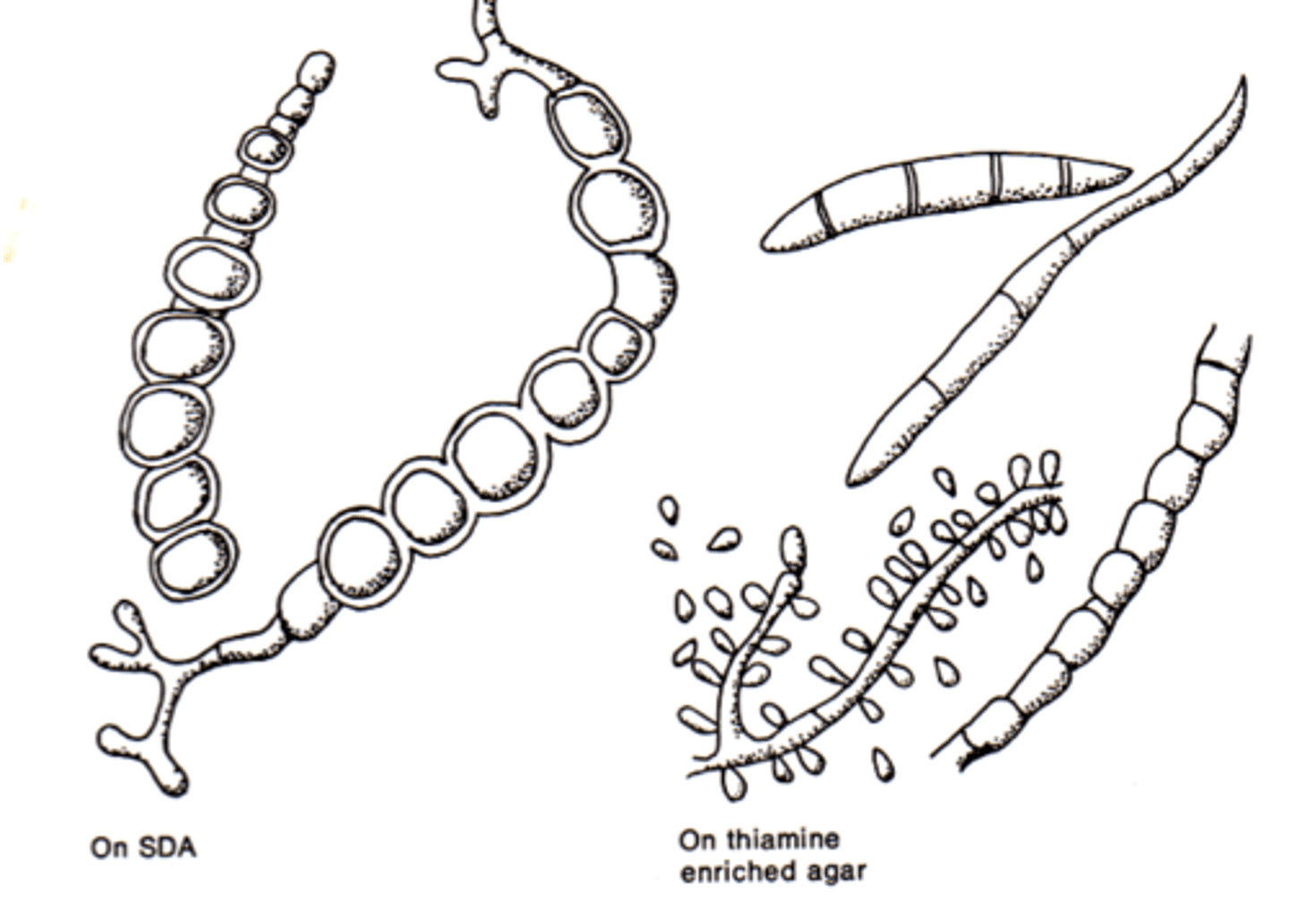 <p>-t. verrucosum requires casein + thiamine</p><p>skin-like, WAXY dimpling the agar, sand$ looking colonies</p><p>macroconidia look like rate tails</p>