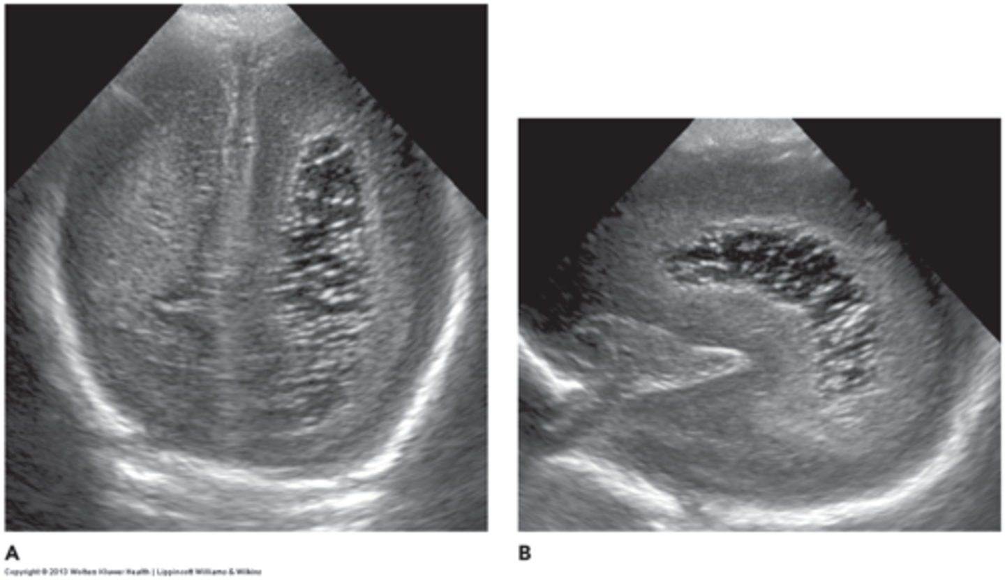 <p>đang phát triển</p>
