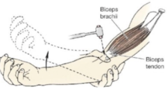 <p>C5-C6, forearm flexion.</p>