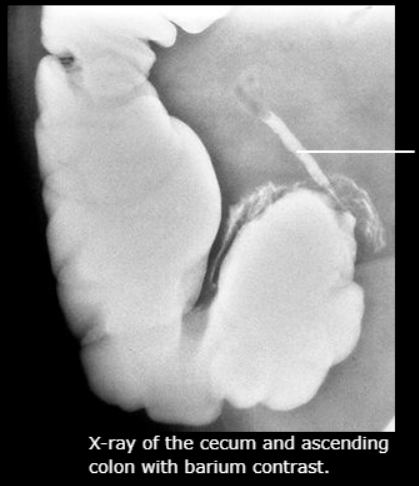 term image