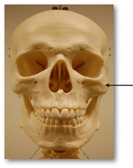 Name this bone.