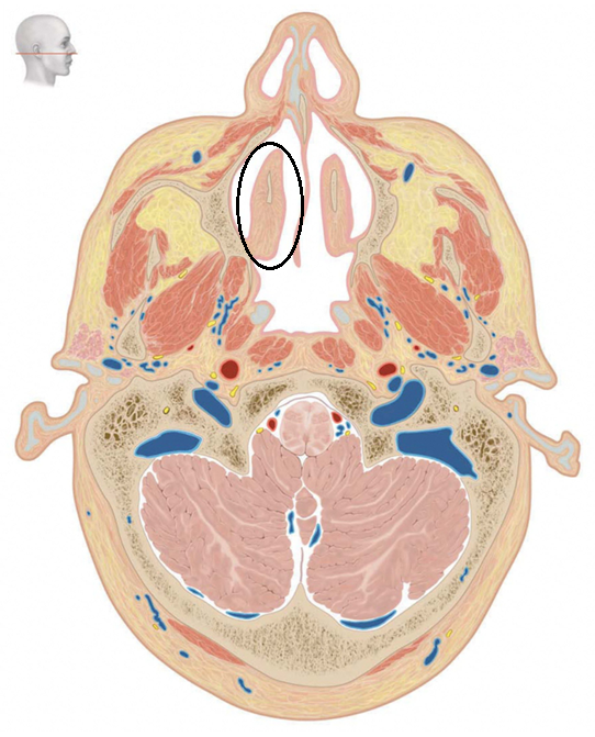 term image