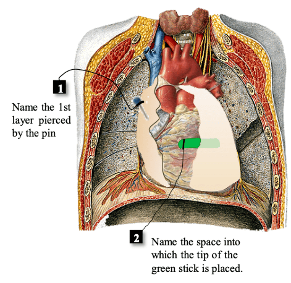 <p>#1</p>