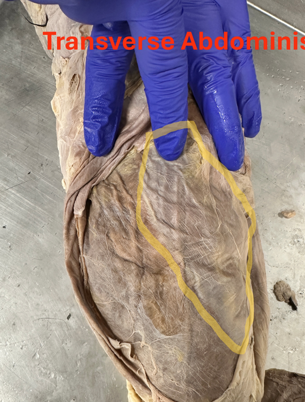 <p>Transverse abdominis (abdominal muscles)</p>