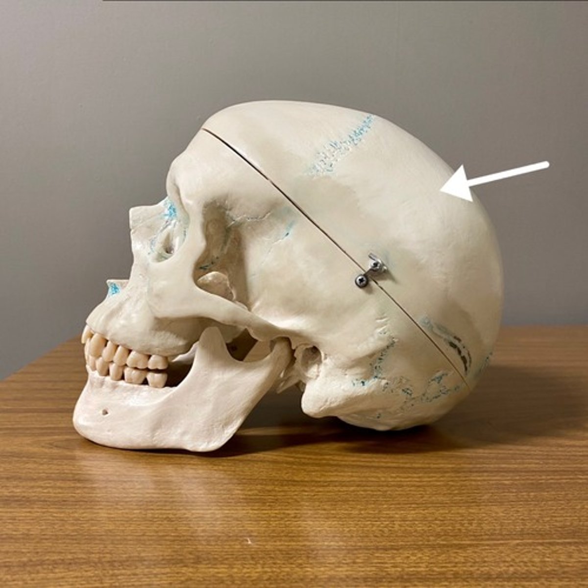 <p>What bone is this?</p>