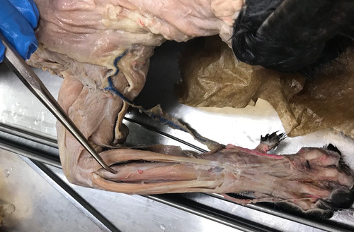 <p>Origin: Lateral epicondyle of humerus</p><p>Insertion: Radius</p><p>Action: Supinates forearm</p>