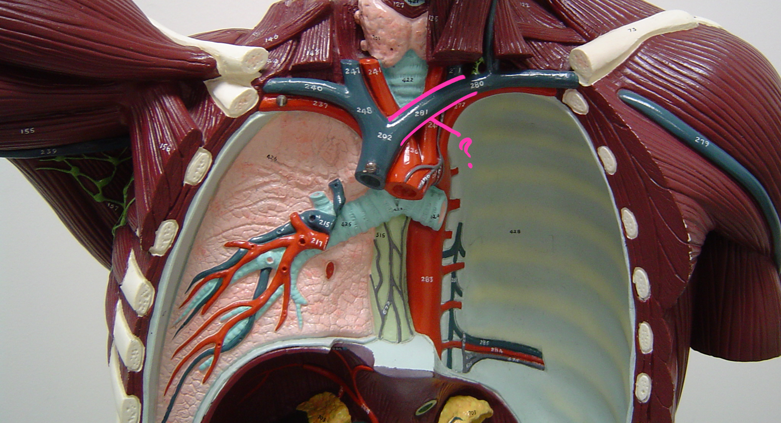 <p>what blood vessel is this? (in pink)</p>