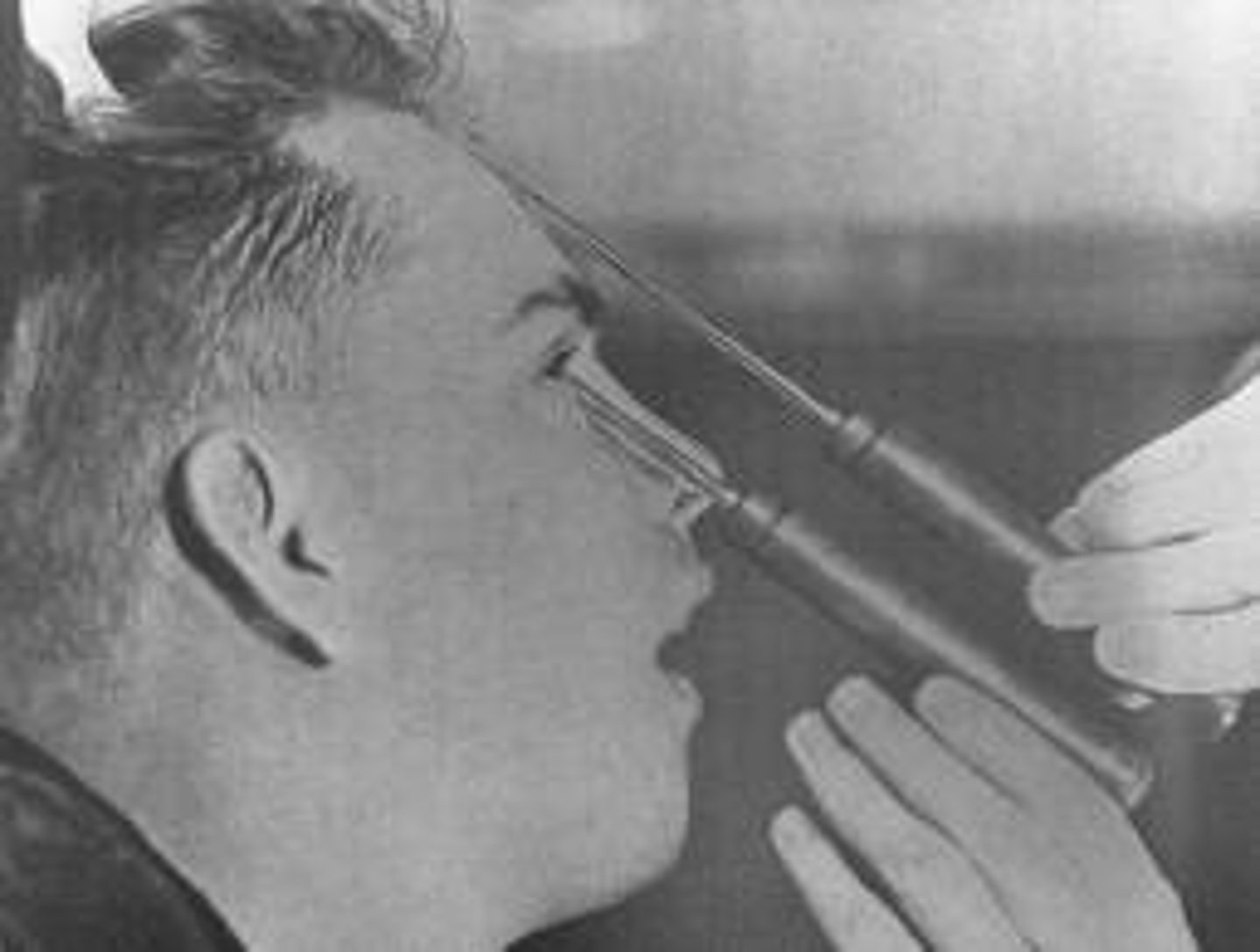 <p>a now-rare psychosurgical procedure once used to calm uncontrollably emotional or violent patients. The procedure cut the nerves connecting the frontal lobes to the emotion-controlling centers of the inner brain</p>