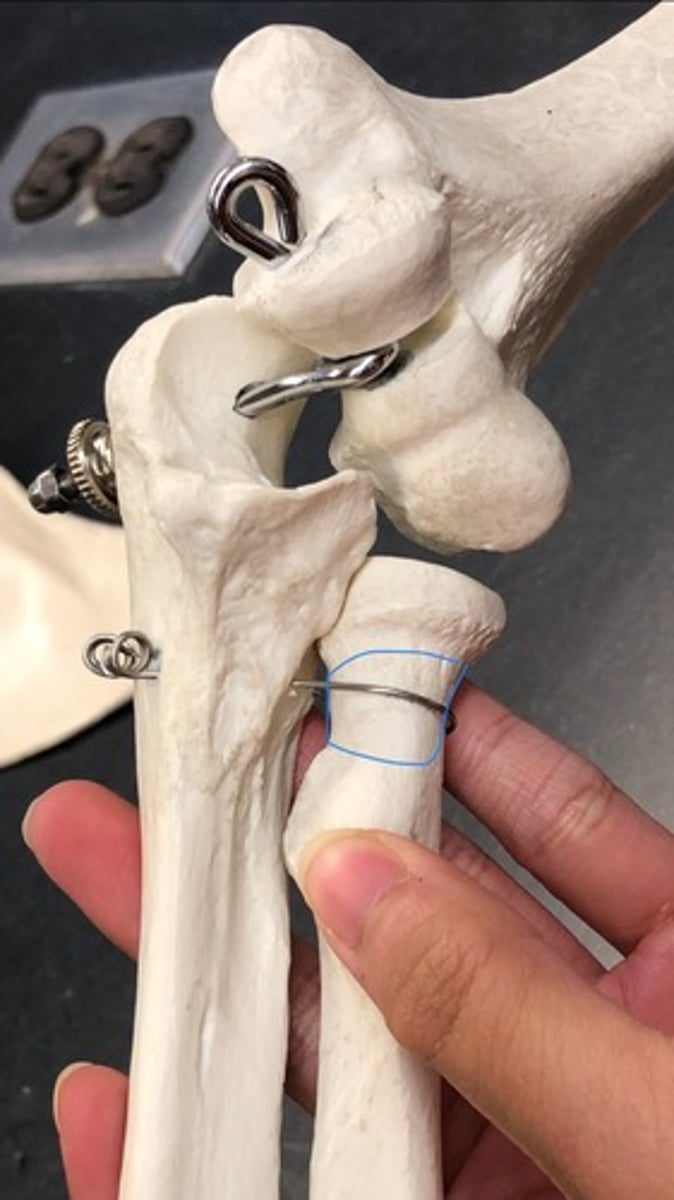 <p>narrows after the head</p>